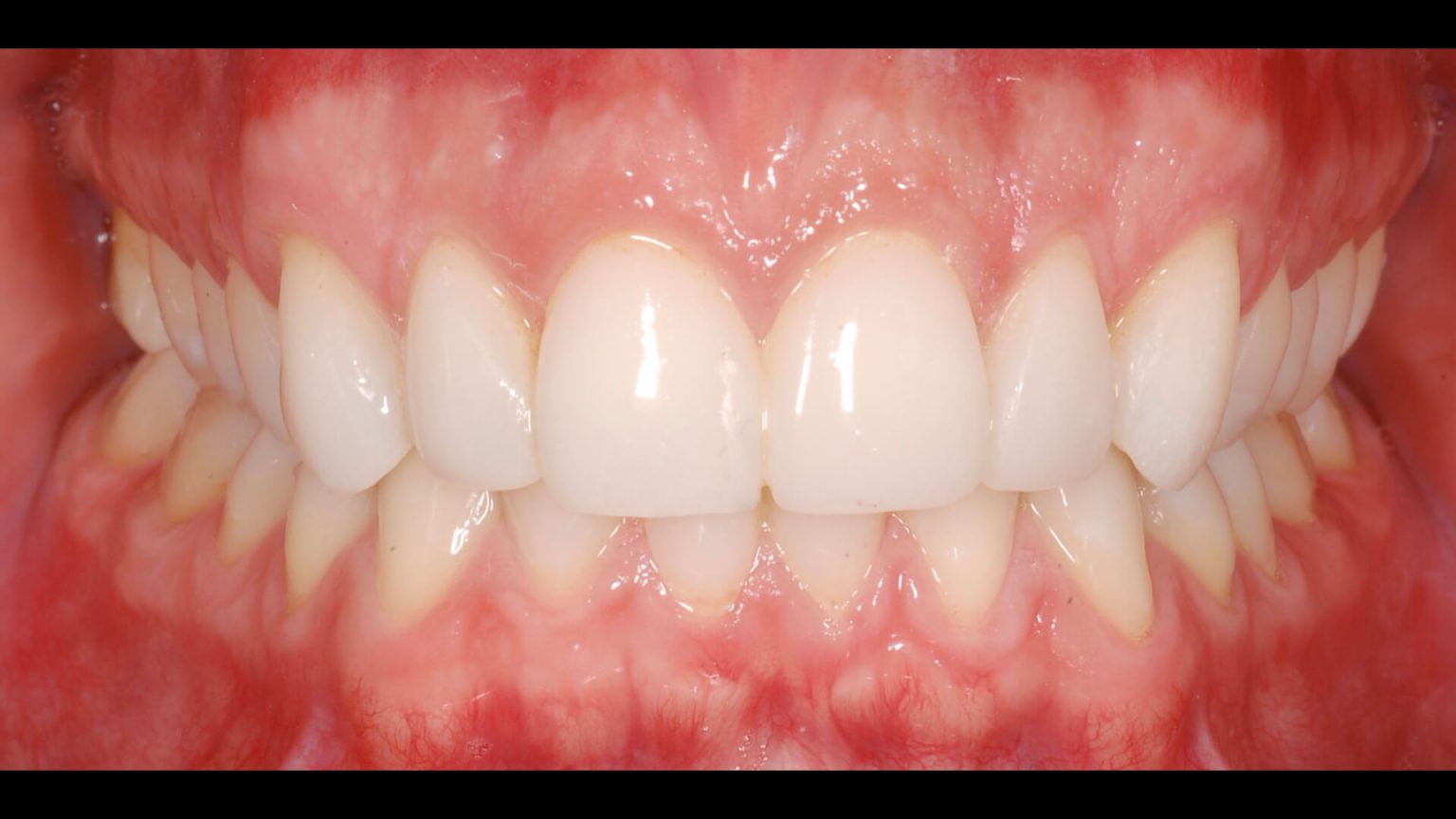 Initial module Occlusion and Differential Diagnosis BOC System